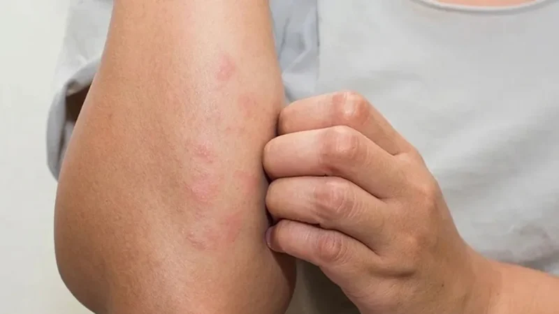 Các dấu hiệu kéo dài vài tuần có thể cảnh báo ung thư