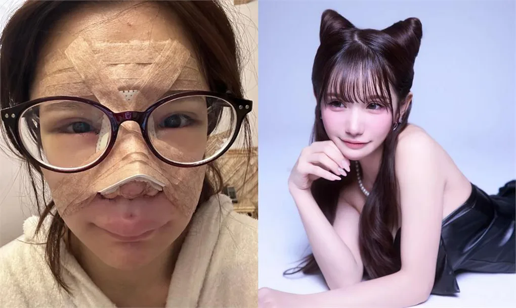 Bị miệt thị ngoại hình, cô gái Nhật chi hàng chục triệu yên 'đập đi xây lại'